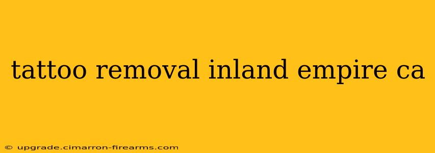 tattoo removal inland empire ca